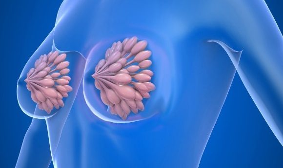 MED12: a potential diagnostic tool to distinguish breast cancer from  fibroadenoma - Oncology Central