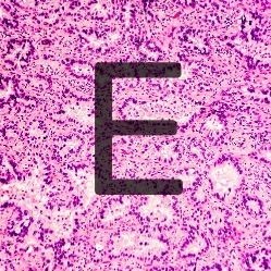 Given that EGFR is expressed by many lung cancer tumors, it has become an important therapeutic target. 