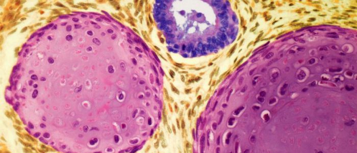 The Science of the "Liquid Biopsy": Understanding miR-371a-3p