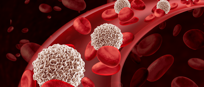 tumor metastasis