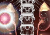 advanced renal cell carcinoma