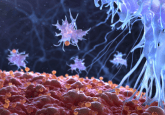 urothelial cancer