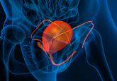 avelumab