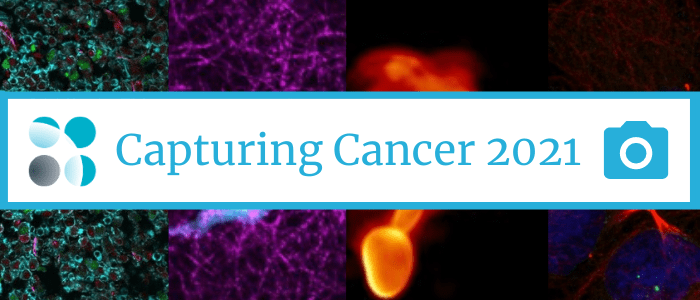 Capturing Cancer 2021