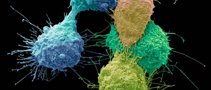 gynecological cancer