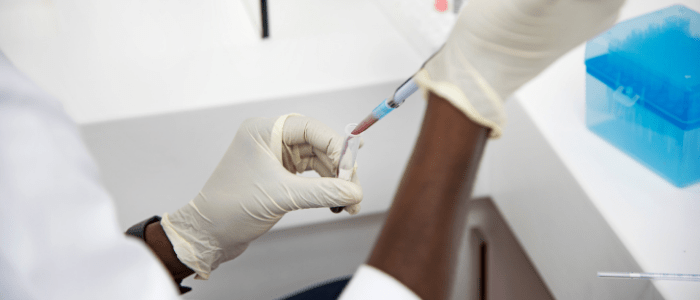 liquid biopsy