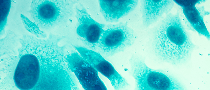 PSMA PET imaging