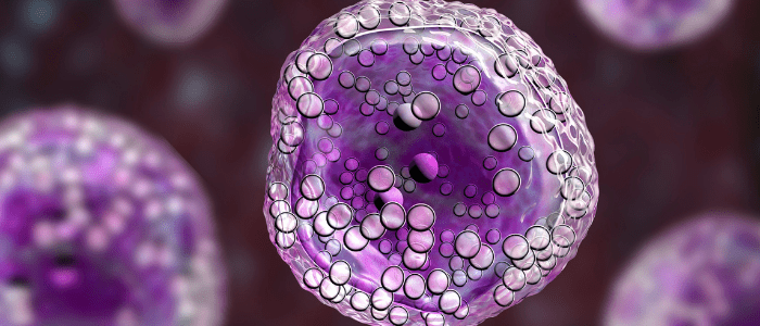 AACR COVID-19 and Cancer