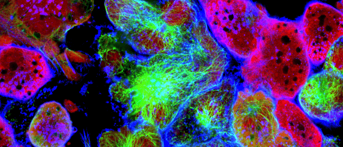 Tumor microenvironment