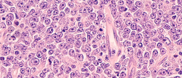 Copanlisib