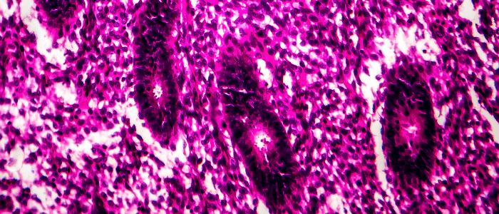 dostarlimab