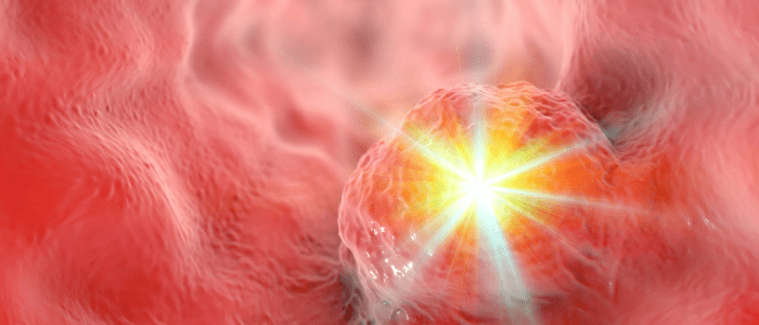 nivolumab