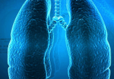 lung cancer, NSCLC, Osimertinib