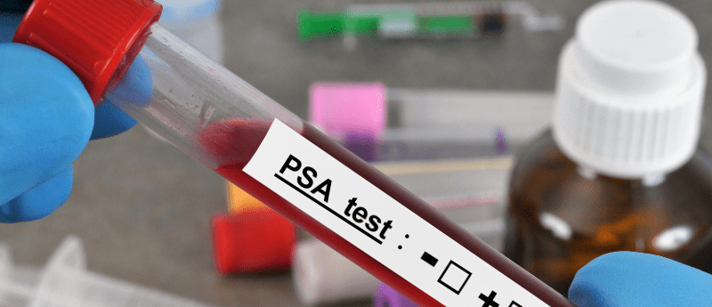 prostate cancer screening