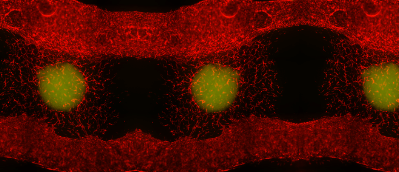 METTL1: a novel target for drug inhibition that could treat numerous aggressive cancers