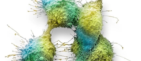 tumor-cells-metastasis