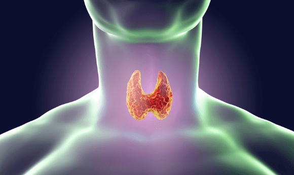 thyroid cancer