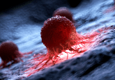 tenosynovial giant cell tumor