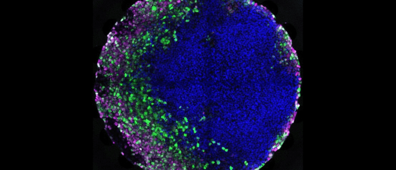 immunotherapy second-line