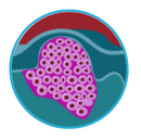 Skin cancer prognosis