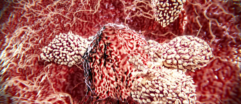 gut microbiome