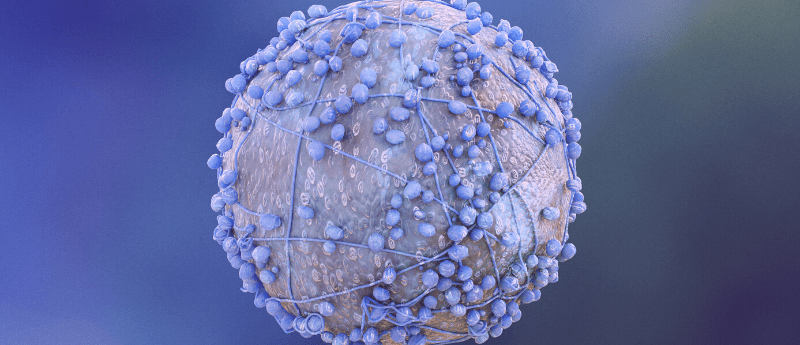 DCIS Wisdom trial