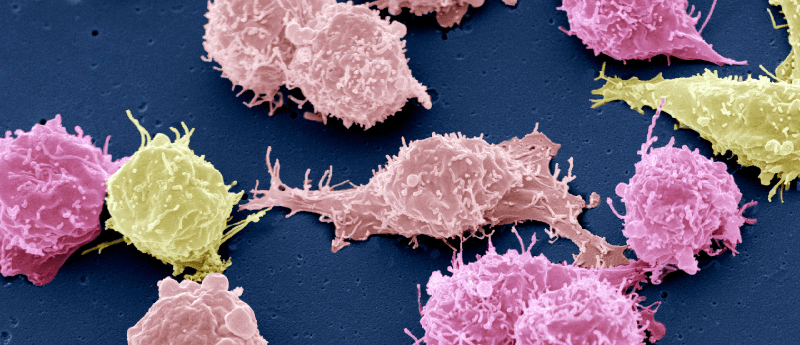 pembrolizumab asco 2023