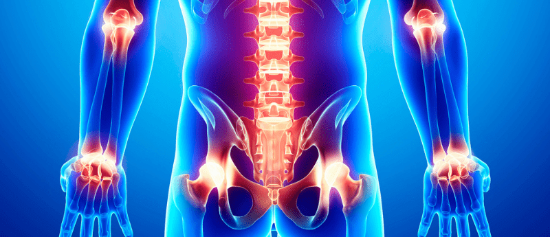 sacroiliitis joint pain