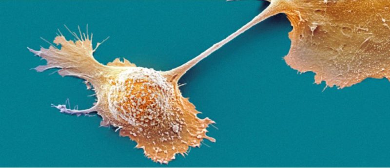 3D-printed tumor