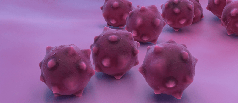 Mandana Kamgar pancreatic cancer